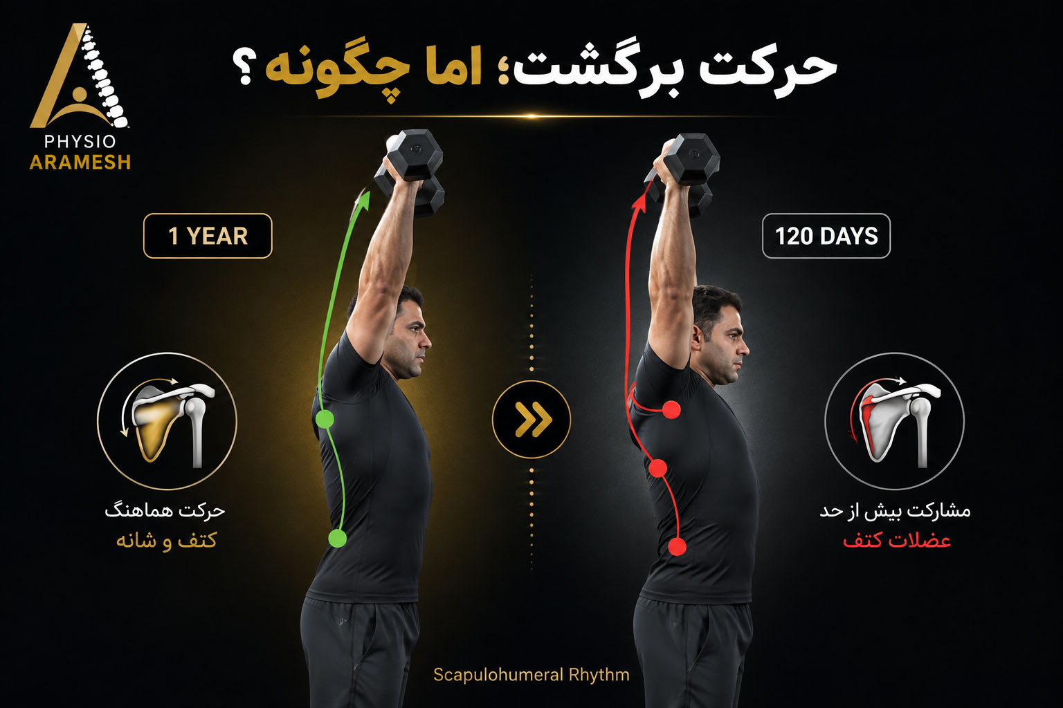 ریتم حرکت کتف و شانه پس از جراحی